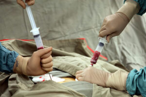 Трансплантация костного мозга