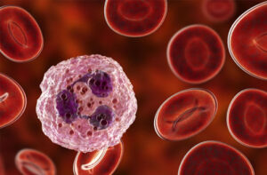 агранулоцитоз