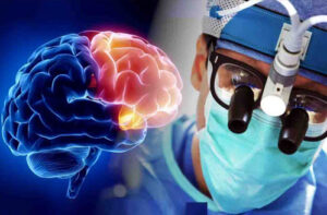 менингиома