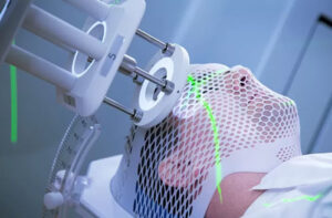 протонная терапия