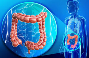 Лечение дискинезии толстой кишки в Германии
