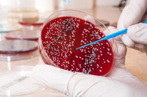 Лечение рака крови в Израиле