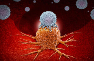 Лечение аденокистозного рака в Турции