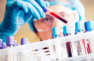 Лечение миелолейкоза в Германии